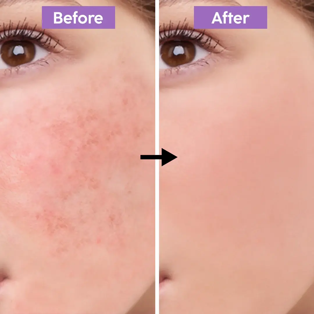 APLB Glutathione Niacinamide Facial Cream 55 gm Buy And Get Beauty Glazed Lip Oil product image