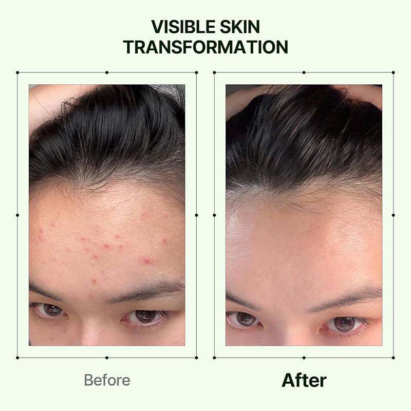 ORIEN Mugwort Zero film In Toner 160ml product image