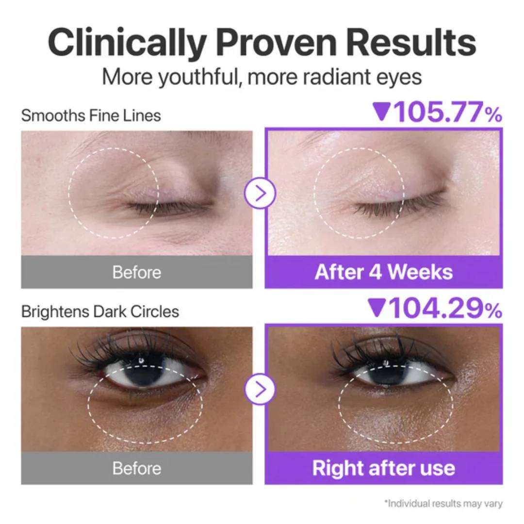 Numbuzin No.9 NAD+ Retinol Volumetox Eye Cream product image
