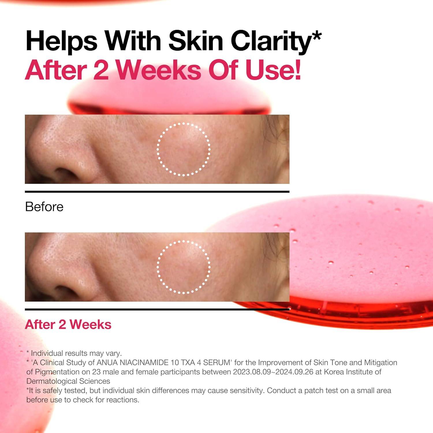 ANUA Niacinamide 10%+ TXA 4% Serum 10ml product image