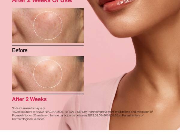 KDH ANUA NIACINAMIDE 10 TXA 4 SERUM 50ml product image
